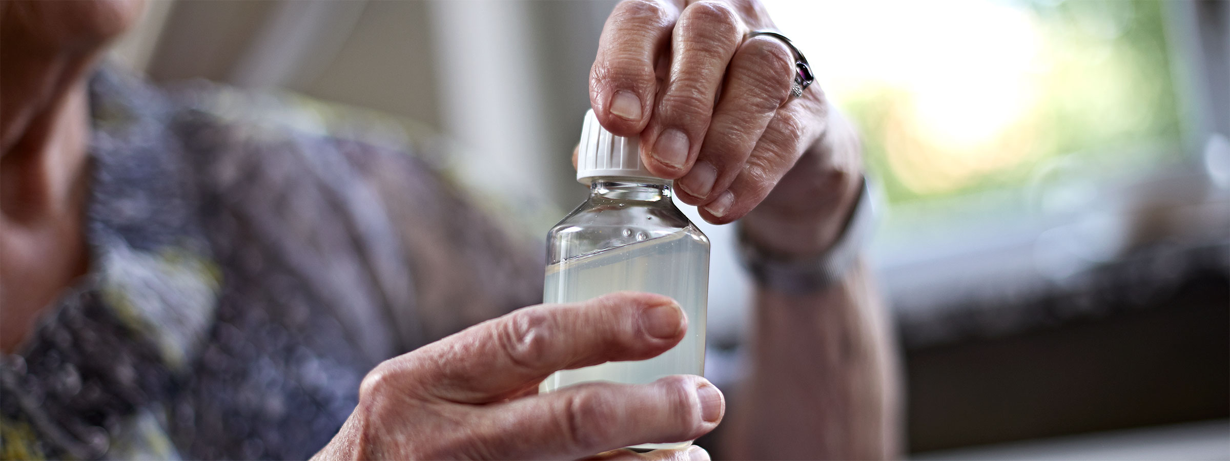 β-乳球蛋白（BLG）